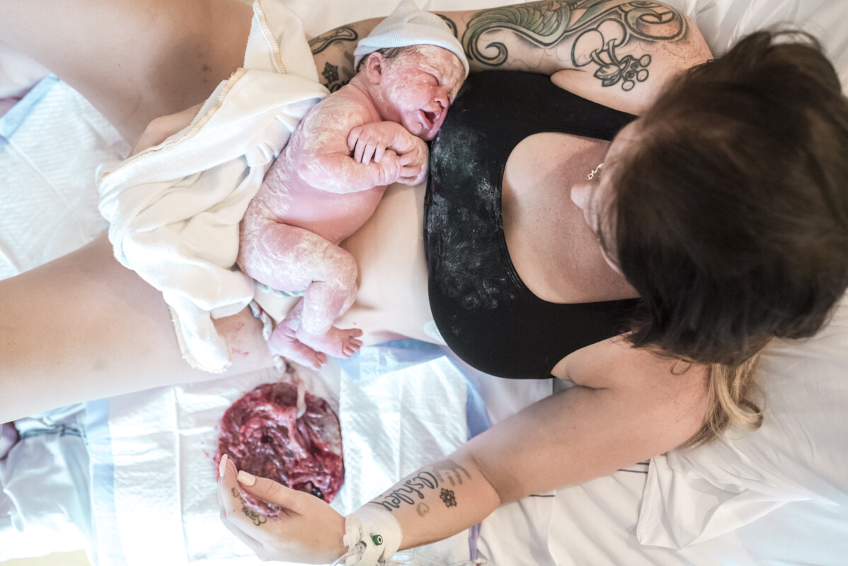 placenta lotus bevalling