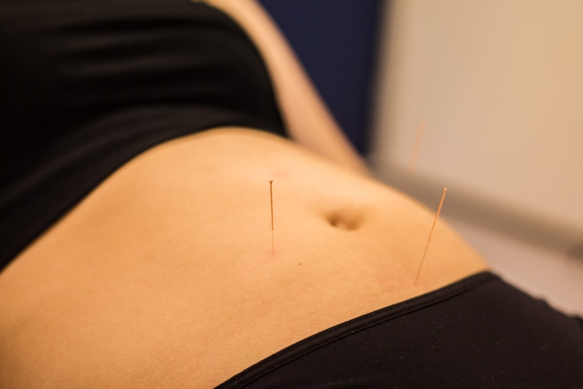 acupunctuur